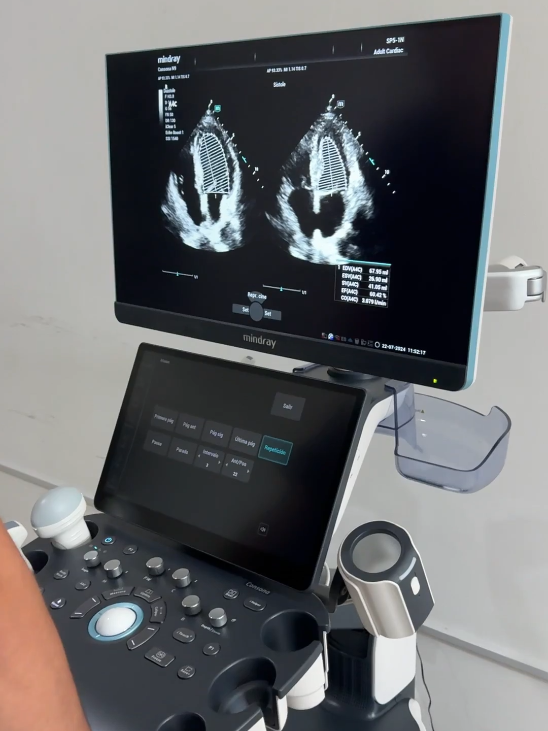 Mindray serie N modelo Consona N9 #Mindray #Consonan9 #ginecologiaeobstetricia #Biomedica #cardiologia#meridayucatanmexico