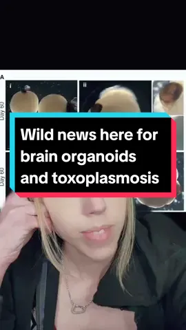 #sciencenews #toxoplasmisis #brainorganoid ##greenscreen