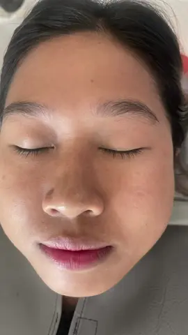 Bb glow treatment 🩷#bbglowtreatment #treatment #facial #bbglowfacial #face #beauty #BeautyTok #beautytip #fyp #foryou 