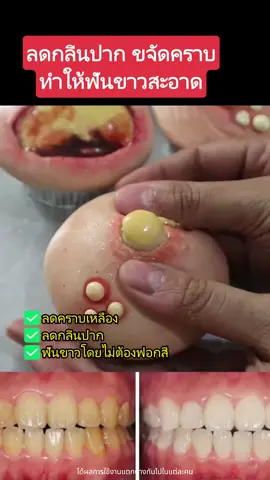 ฉันซื้อยาสีฟันหลังจากอ่านรีวิว และมันทำให้ฉันขาวขึ้นจริงๆ#canban 31.7.2