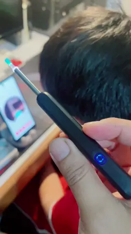 Pembersih telinga endoscope endoskopi telinga pembersih kuping #pembersihtelinga #pembersihkuping #endoscopy #endoskopi  #endoscope 