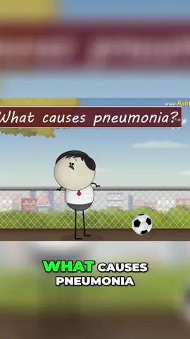 What is Pneumonia? Causes, Symptoms, and Treatment | Understanding Lung Infection Learn about pneumonia, a lung infection caused by microorganisms, and its impact on breathing. Discover how harmful microorganisms can bypass the respiratory tract's defense mechanisms and reach the alveoli, leading to infection and inflammation. Find out how the immune system responds and the resulting difficulty in breathing. Stay informed and protect your respiratory health. #Pneumonia #LungInfection #RespiratoryHealth #BreathingDifficulty #Microorganisms #Inflammation #ImmuneResponse #Alveoli #RespiratoryTract #HealthEducation
