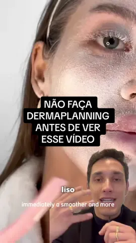 Você já viu esse vídeo que está viralizando na rede vizinha? Elas usam um spray que ajuda a identificar os pelos do rosto e facilitam o dermaplanning. Vocês fariam?