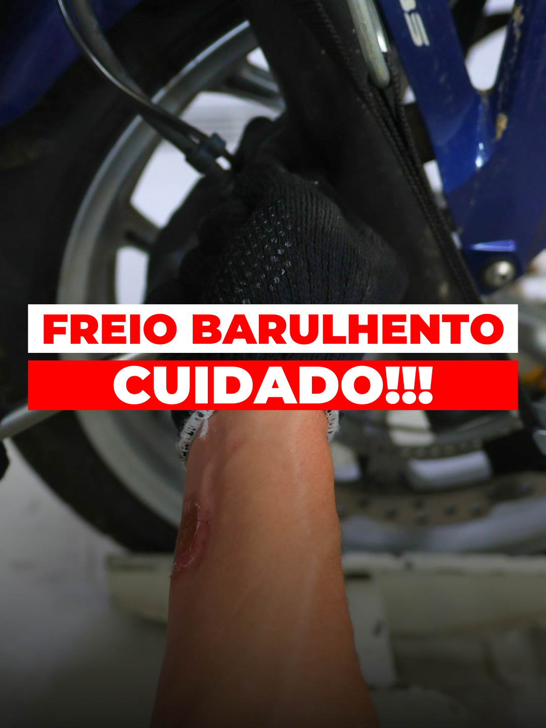 Rodar assim pode ser arriscado, fique de olho! Muita gente diz que é normal um barulhinho no freio da moto, realmente, o atrito entre as pastilhas e o disco de freio emitem um ruído, mas... E quando esse som começa a ficar esquisito? 🤔 Aí uma atitude tem que ser tomada de imediato, pois sua segurança começa a ficar em risco. 🚨 Veja no vídeo a seguir o que nosso mecânico especializado indica nesses casos. 🔗 Assista ao vídeo e confira!🏍️💡 📍 Joinville: Av. José Vieira, 2111 - América 📍 Jaraguá do Sul: Rua Prof. Adélia Fischer, 239 - Vila Baependi 👉 Fale conosco pelo WhatsApp: (47) 98409-1024 #DicasDeMoto #CuidadosComAMoto #ManutençãoPreventiva #HondaKGMotos #Joinville #JaraguáDoSul #SegurançaNoTrânsito #MotoSegura #RevisãoDeMotos #CuidandoDaSuaMoto #VidaDeMotociclista #BaixaCilindrada #PrevençãoDeAcidentes #DicasDeManutenção #MotociclistaSeguro #HondaBrasil #Motos #VidasEmPrimeiroLugar