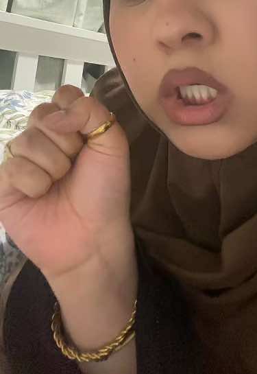 Earless power!!!! ✊🏼 