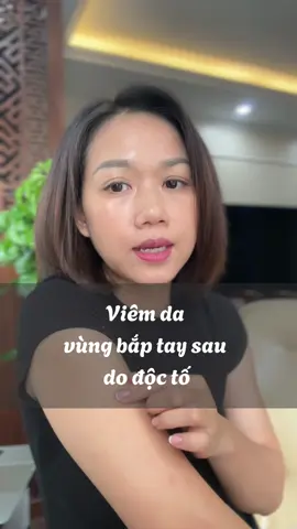 Sống chung với mụn bắp tay sau cả chục năm trời #nhungthuy #nhungtrehoa #hanhtrinhtrehoa #menguunghe #detox #daythi 