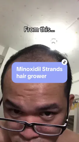 #minoxidil #minoxidilstrands #hairloss #hairgrower #jeffjameszarate 