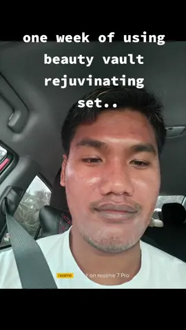 One week of using the product sobrang effective 