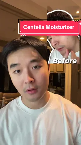 แจกไอเทมลับ!ที่ช่วยทำให้ผมหน้าใสได้ 365 วัน แถมราคานักศึกษามากๆ ##glad2glowth#หน้าใสไร้สิว #centella #ใช้ดีบอกต่อ #น้ำโต้น #namton #numton