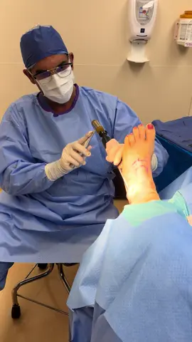 This looks  easy but literally took a few times to place an anchor exactly in a patient🛠️🪛🪚……..#anklerepair #anchor #osteoarthritis #footpain #podiatrist #theOC