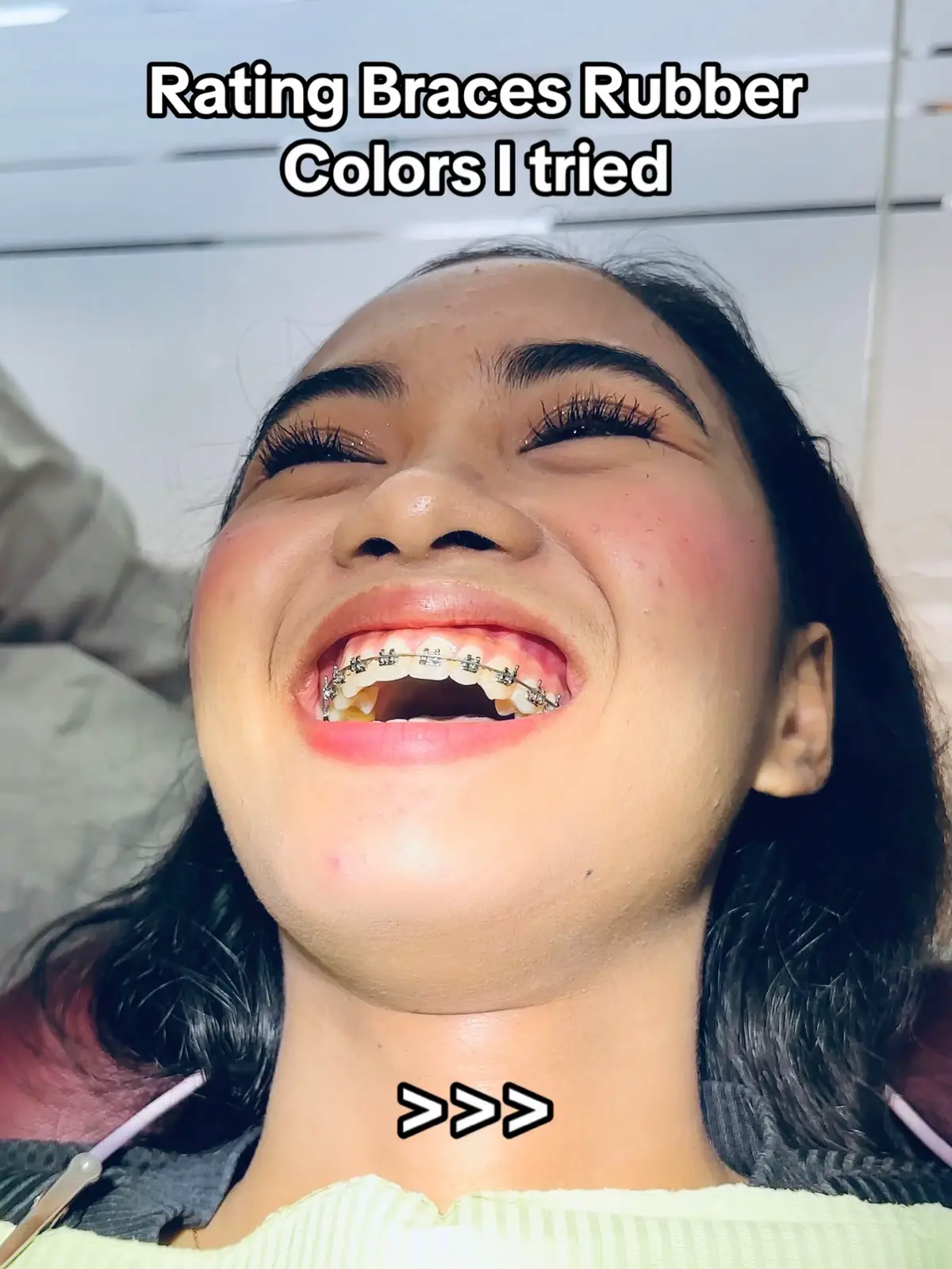 Rating yan ha base sa itsura sa ngipin ko at sa itsura🤣 #braces #bracescolors #bracestips #bracesguide #bracesjourney #fyp #camillevelasco #FindItAtWatsons 