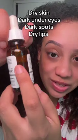 Dark under eyes dry skin dry lips and dark spots #skincare #darkspots #hyperpigmentation #darkundereyes #darkcircles #drylips #exzema #theordinary 