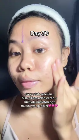 nyesel bgt baru cobain exfo serumnya finally found you😭 #fyp #acneprone #exfoserum 