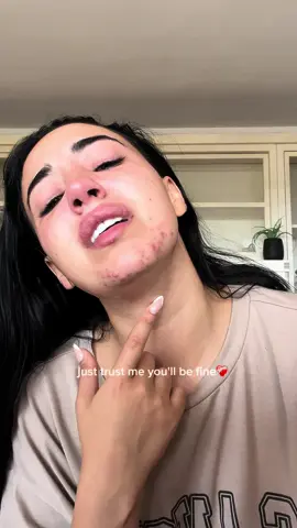 Verano 2023 vs Verano 2024❤️‍🩹 #acne 