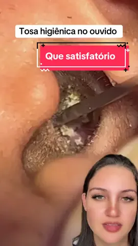 Cara eu gosto de videos assim, acho muito satisfatório #limpezasatisfatoria #reagindo #terapia #satisfatório #ouvido 