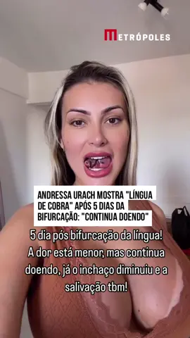 Um dos assuntos desta semana, #AndressaUrach tornou a usar as redes sociais neste sábado (3/8) para atualizar os seguidores sobre o estado de sua língua. A modelo decidiu bifurcá-la há cinco dias, passando por uma cirurgia em #SãoPaulo. Desde então, Andressa tem mostrado como ficou o órgão depois do procedimento. No vídeo deste sábado, ela desabafou: 