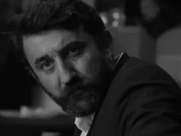 🤕 #cukur #sad #kocovalibrothers #foryou #global 