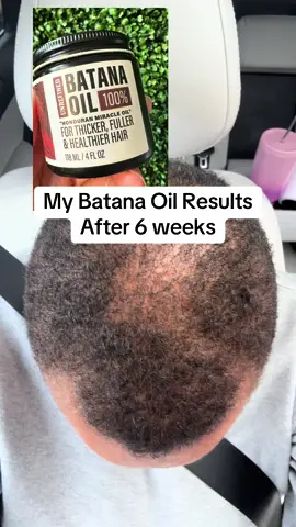 #TikTokCreatorSearchInsightsIncentive #batana batana oil before and after results honduras honduran @Hotana formerly The-Mix-Up 