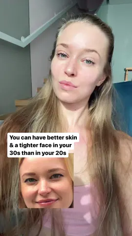 he 10-Min Full Face Massage that’s pinned on my main profile (not the Reels, but the IG Field). If you’re really serious about transforming your face, my 30-Day Face Transformation Program is perfect for you - but unfortunately enrollment is currently closed. You can join the Waitlist to not miss out next time it opens 😊  #beforafter#facemassage#beautyfascia#facesculpting#hoodedeyes#SelfCare#slefmassage#GlowUp 