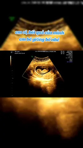 #rongvang2024 #mẹbầu #trendmoi #kienthucmebau 