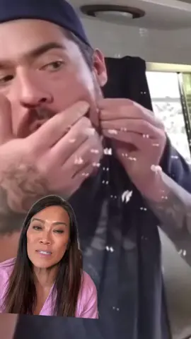 PLEASE if you have a pimple or even a cyst that is inflamed or infected, if you cant get a presciption antibiotic right away, at least use something like a Benzoyl Peroxide Spot Treamment which can help prevent bacteria from thriving in the area! @Pimple Satisfying #greenscreenvideo 