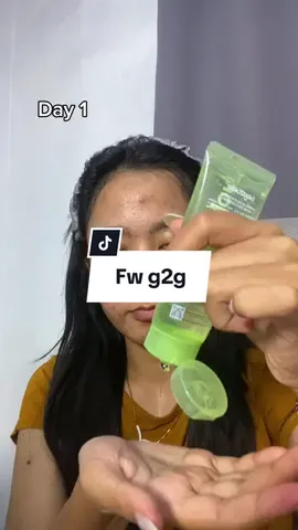 Masuk list fav fw g2g yg ini😩🫶🏻 #acnefighter #acnecleanser #acnefacewash #acne 