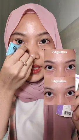 Waduh @Emina Store tau aja remaja2 jaman sekarang sukanya begadang😔  Ini dia Emina Glorad Eye Wake Up Roller! Bisa bantu mencerahkan kantong mata sekaligus bikin mata jadi seger lho!  Kandungan niacin-peptide nya bisa bantu mencerahkan dan menenangkan puffy eyes👀 #EyeSerum #GlowGuaranteed #EminaGloRad #Emina #EminaCosmetics 