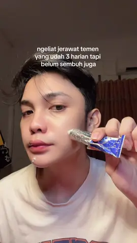 produk jepang gapernah gagal😖🙌🏻 #acnepair #acnecream 