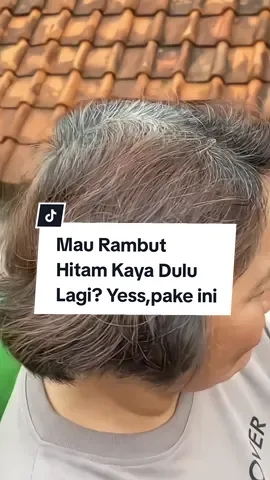 Mau Rambut Hitam Kaya Dulu Lagi?yess,coba pake shampo my iwe beneran efektif #hairdye #uban #penghitamrambut #penghilanguban #ubanrambut #reviewjujur 