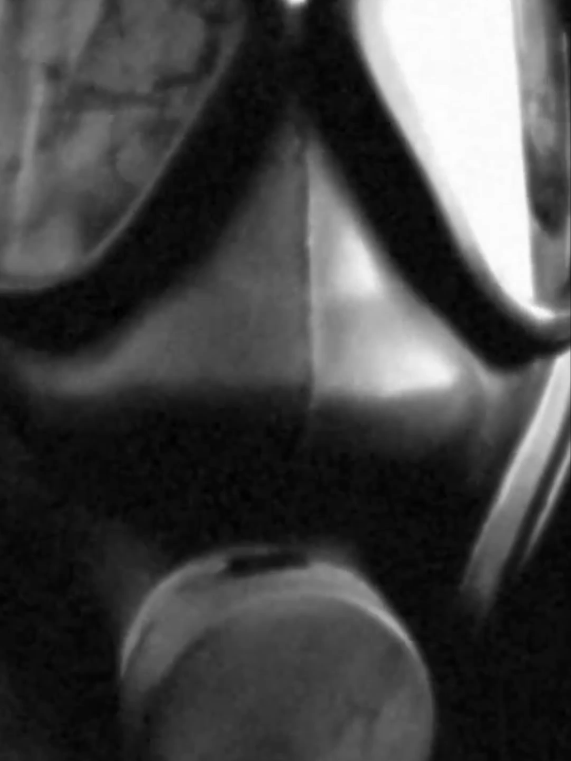 Here is a clip from the Childhood’s End official music video #PinkFloyd #fyp #ChildhoodsEnd #AltMusic