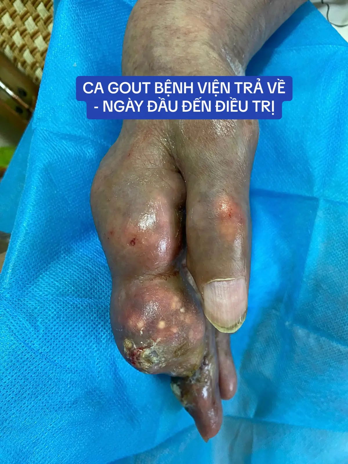 #sôngkhoe247 #sức_khỏe_là_vàng #xương_khớp #Khoáng_Sinh_Học_Minexin #Công_Nghệ_M_A_P #Đột_Phá_Ngành_Sức_Khoẻ_Spa_Thẩm_Mỹ 