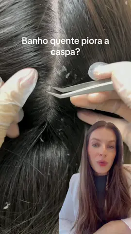 Sera que banho quente piora a caspa? #caspa #dermatiteseborreica #banhoquente 