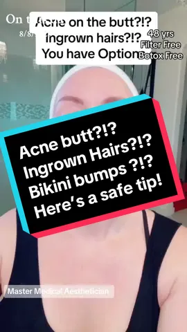 #onthisday  Body care, body acne or ingrown hairs? You need this little trick. #ingrown #ingrownhair #acne #acnetreatment #bikini #skincare 