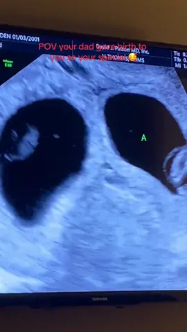 When your Daddy gives you your first best friend 🩵 this is your sign to pursue a family even if its not “traditional” the love is the same. 🥰#transdad#seahorsedad#twingirls#explorepage#fyp 