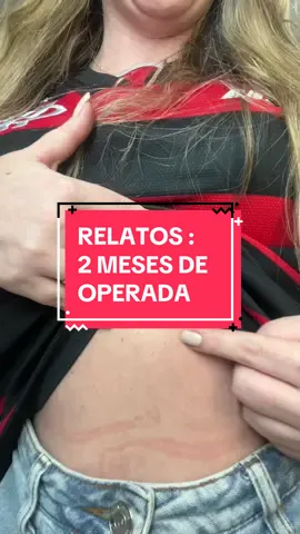 Se tiverem mais duvidas, podem deixar aqui nos comentarios🥰 meu medico é o dr Alexandre Cerqueira, ele atende em jacarepagua e na barra #retiradadevesicula #pedranavesicula #herniaumbilical #cirurgiavesicula #vesicula 