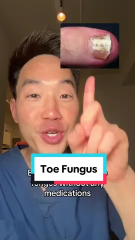 Toe Fungus #dermatology #drdavidkimderm #fungus #skincareroutine #skincare #vinegar #toefungus #hygiene #skintok #learnwithtiktok #greenscreensticker 