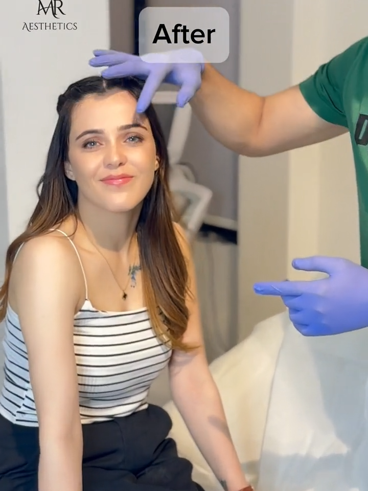 Botox Treatment By @dr_malikrizwan at @mraestheticsclinic Celebrate this Azadi with 14% OFF Book Your Appointment Today and enjoy the sale before 14th of August. #trending #fyp #fypシ #tiktokpakistan #viral #viralvideo #fyppppppppppppppppppppppp #botox #skincare #beauty #tiktokindia