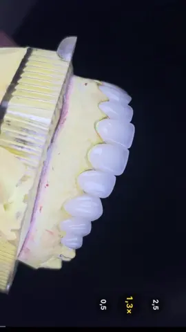 Cách em chụp ảnh đây . Rất đơn giản phải k ace ! #dental #dentallaboratory #rangsuthammy 