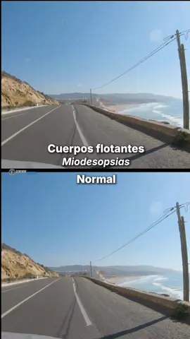 Cómo ven el mundo las personas con condiciones médicas: moscas volantes Comenta si las has visto #miodesopsia 