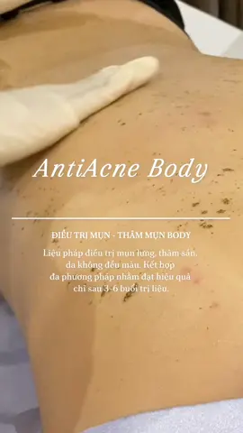 🌟🌟 #suawang #esthetic #spa #homespa #relax #beauty #clinic #facialtreatment #detox #skin #acne 