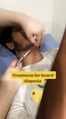 Treatment for beared alopecia ❤️❤️#bearedalopecia #hairloss #injection for alopecia