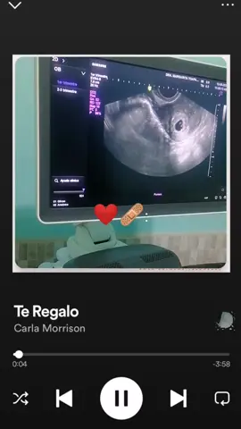 #CapCutAmor #CapCut ahora si la puedo cantar 