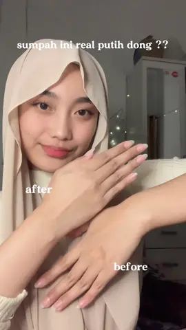 beneran worth to buy‼️ kmarin aku sempet belang karna dari wahoo tp sekarang warna kulitnya udah balik lagi pake produk daru @miniolab 🥺 #susahputih #auramaghrib #pemutihviral 
