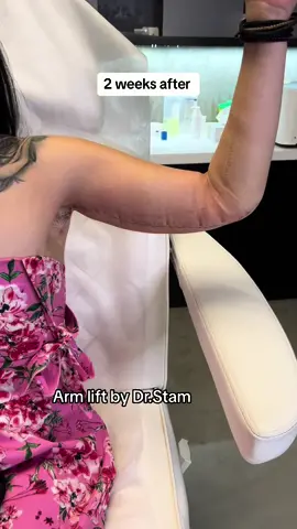 #arm #lift #looseskin #fypage #fyp #fypシ゚ #tiktok #viral 