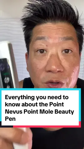 Everything you need to know about the Point Nevus Point Mole Beauty Pen. Used for skin tag, wart, mole and tattoo removal #skincare #skintagremoval #wart #beauty #beautypen 