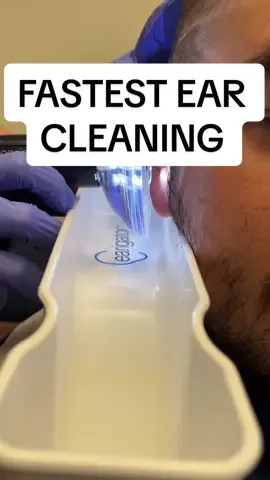 Wax removals are fast AF when the @earigator is involved ❤️