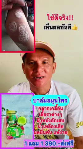#บาล์มนงลักษณ์กล่องเขียว #เชื้อราในร่มผ้า #กลากเกลื้อนน้ำกัดมือเท้า #เสก็ดเงินงูสวัด #ออแกนิค100% #สินค้าขายดี 