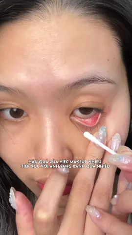 Thứ không thể sống thiếu của những người cận thị, thường xuyên makeup, hay dùng điện thoại,…. #goclamdep #reviewlamdep #nuocruamat #eyefresh 