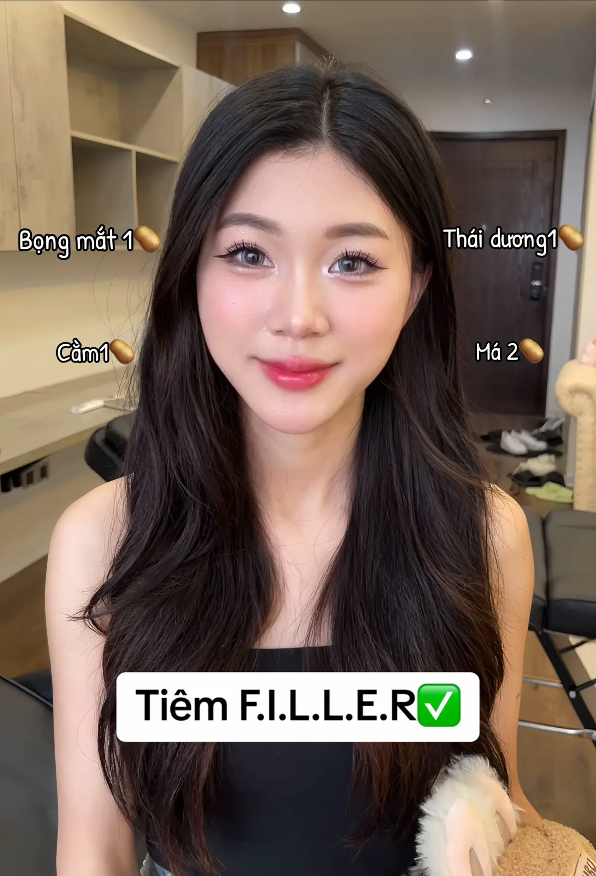 #xuhuong #trending #filler #botox #lamdep #bienhinh #tiplamdep #xh 