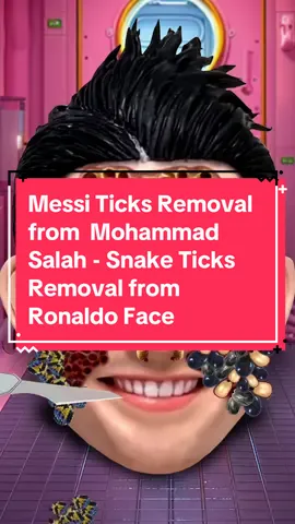 Messi Ticks Removal from  Mohammad Salah - Snake Ticks Removal from Ronaldo Face.. #asmr #animation #calmcareclinic #facecare #cleaning #ronaldo #messi #salah 
